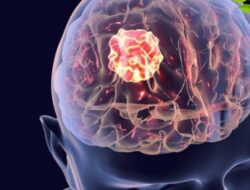 Ini Dia 5 Minuman Pembersih Otak Kotor, Cegah Demensia dan Stroke