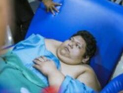 3 Species Cacing Ditemukan Tim Dokter RSCM di Tubuh Fajri Pria Obesitas 300 Kg