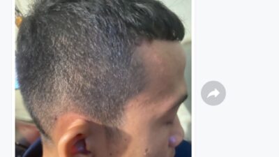 Korban yang dianiaya, Dimas Abdi Nugroho