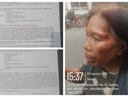 Terduga Korban Penganiayaan di Depan Tiara Convention Center Polisikan Puput ke Polrestabes Medan